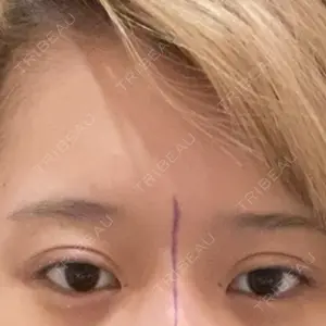 口コミ