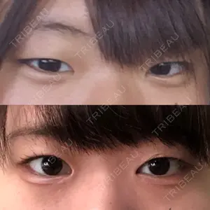 東京皮膚科・形成外科 東京皮膚科・形成外科 (銀座いけだクリニック)口コミ