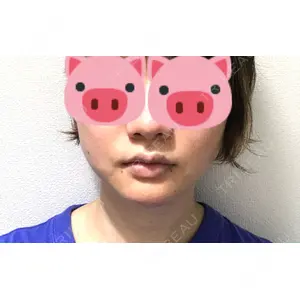 口コミ
