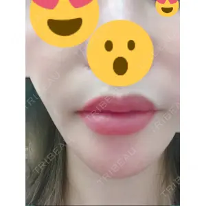 口コミ