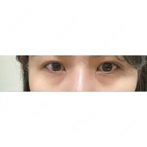 APOLLO BEAUTY CLINIC口コミ