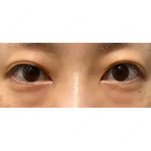 APOLLO BEAUTY CLINIC口コミ