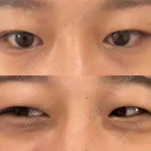 TCB東京中央美容外科 TCB東京中央美容外科 新宿三丁目院口コミ