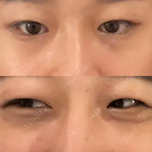 TCB東京中央美容外科 TCB東京中央美容外科 新宿三丁目院口コミ
