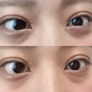 APOLLO BEAUTY CLINIC口コミ