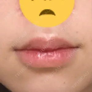 B-LINE CLINIC B-LINE CLINIC 池袋院口コミ