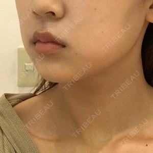有楽町美容外科クリニック口コミ