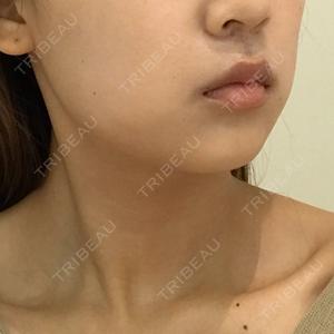 有楽町美容外科クリニック口コミ