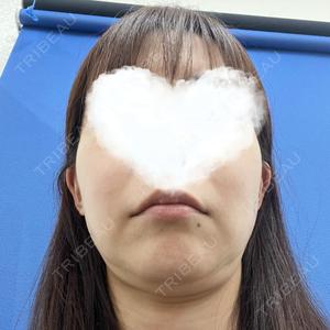 口コミ