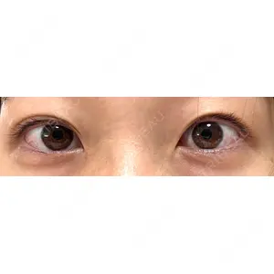 いちのせ形成外科・皮膚科 眼瞼＆フェイスクリニック口コミ