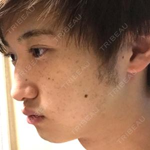 湘南美容クリニック 湘南美容クリニック 柏院口コミ