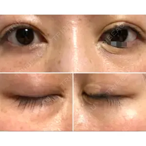 APOLLO BEAUTY CLINIC口コミ