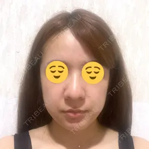 TCB東京中央美容外科 TCB東京中央美容外科 新宿三丁目院口コミ