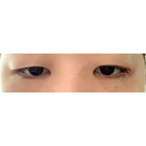 東京BELLEZZAクリニック口コミ