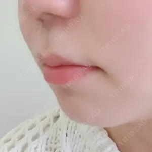 口コミ