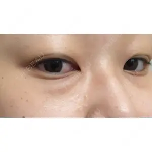 APOLLO BEAUTY CLINIC口コミ