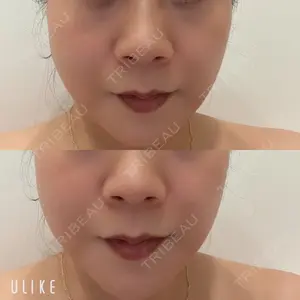 X CLINIC X CLINIC 銀座院口コミ