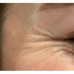 湘南美容クリニック 湘南美容クリニック 東京蒲田院口コミ