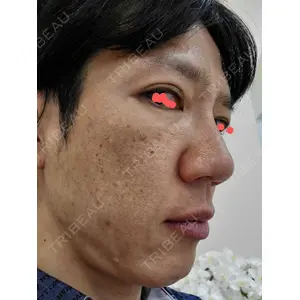 百人町アルファクリニック口コミ
