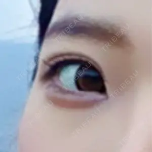 湘南美容クリニック 湘南美容クリニック 柏院口コミ
