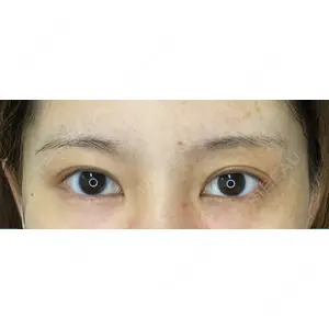 東京BELLEZZAクリニック口コミ
