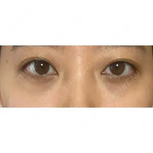 APOLLO BEAUTY CLINIC口コミ