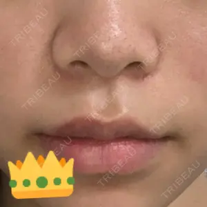 東京皮膚科・形成外科 東京皮膚科・形成外科 (銀座いけだクリニック)口コミ