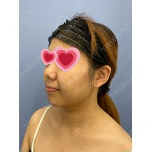 湘南美容クリニック 湘南美容クリニック 秋葉原院口コミ