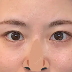 口コミ