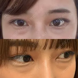 APOLLO BEAUTY CLINIC口コミ
