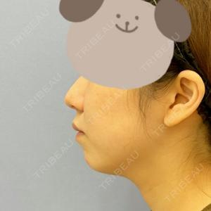 湘南美容クリニック 湘南美容クリニック 秋葉原院口コミ