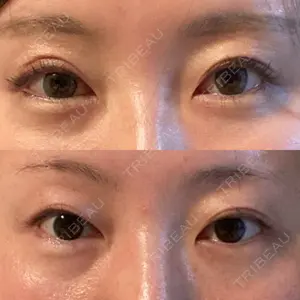 口コミ