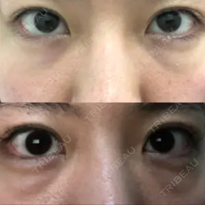 APOLLO BEAUTY CLINIC口コミ