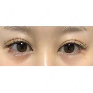 APOLLO BEAUTY CLINIC口コミ