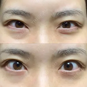 APOLLO BEAUTY CLINIC口コミ