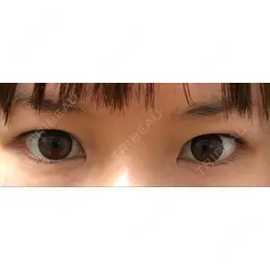 口コミ
