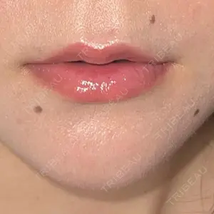 ルラ美容クリニック ルラ美容クリニック 高田馬場院口コミ