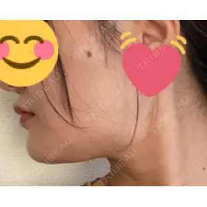 湘南美容クリニック 湘南美容クリニック 静岡院口コミ