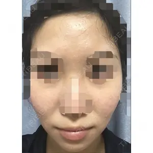 フレッシュ整形外科口コミ