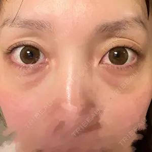 APOLLO BEAUTY CLINIC口コミ