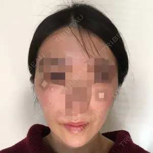 クッキー整形外科の
