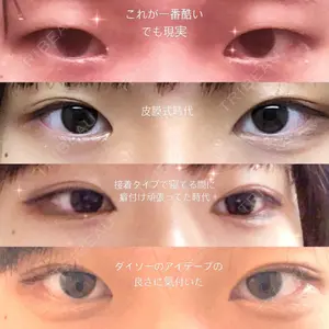 口コミ