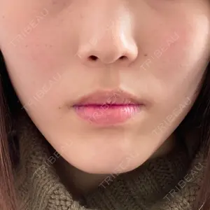 湘南美容クリニック 湘南美容クリニック 自由が丘院口コミ