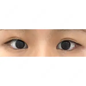 東京イセアクリニック口コミ