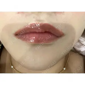 ルラ美容クリニック ルラ美容クリニック 高田馬場院口コミ