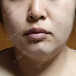 湘南美容クリニック 湘南美容クリニック 金山院口コミ