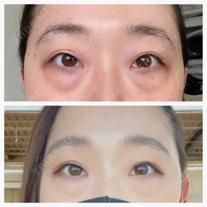 APOLLO BEAUTY CLINIC口コミ