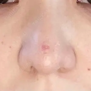 リッツ美容外科 大阪院口コミ