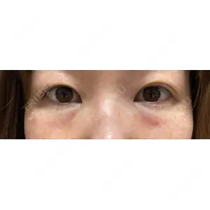 X CLINIC X CLINIC 銀座院口コミ