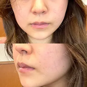 TCB東京中央美容外科 TCB東京中央美容外科 渋谷東口院口コミ